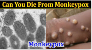 Can u Die From Monkeypox|How do Monkey Pox Start